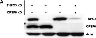 Knockdown Validated: CPSF6 Antibody [NBP1-85676] - TNPO3 KD inhibits HIV-1 replication by shifting CPSF6 to the cytoplasm. Expression level of CPSF6 and TNPO3 in TZM-bl cells stably transduced with control or CPSF6 KD vectors and transfected with scrambled or TNPO3 specific small interfering RNA (siRNA). Cell lysate was probed in western blots with anti-TNPO3 antibody (upper panel), anti-CPSF6 antibody (middle panel) and anti-beta-actin antibody (lower panel). Image collected and cropped by CiteAb from the following publication (//retrovirology.biomedcentral.com/articles/10.1186/1742-4690-10-20), licensed under a CC-BY license.