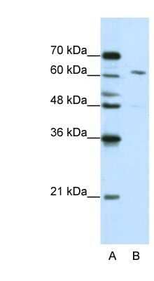 Western Blot: CPSF6 Antibody [NBP1-57541] - Jurkat cell lysate, Antibody Titration: 0.3125ug/ml