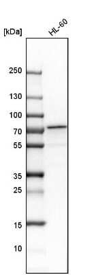 Western Blot: CPSF6 Antibody [NBP1-85676] - Analysis in human cell line HL-60.