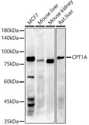 Western Blot: CPT1A Antibody (3M6E9) [NBP3-16072] - Analysis of various lysates, using CPT1A antibody at 1:1000 dilution.Secondary antibody: HRP Goat Anti-Rabbit IgG (H+L) at 1:10000 dilution.Lysates/proteins: 25ug per lane. Blocking buffer: 3% nonfat dry milk in TBST.Detection: ECL Enhanced Kit. Exposure time: 180s.