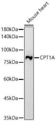 Western Blot: CPT1A Antibody (3M6E9) [NBP3-16072] -  Analysis of Mouse heart, using CPT1A antibody  at 1:1000 dilution. Secondary antibody: HRP Goat Anti-Rabbit IgG (H+L) at 1:10000 dilution.Lysates/proteins: 25ug per lane. Blocking buffer: 3% nonfat dry milk in TBST.Detection: ECL Basic Kit. Exposure time: 30s.