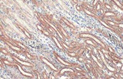 Immunohistochemistry-Paraffin: CPT1A Antibody [NBP2-15993] - Mouse kidney. CPT1A stained by CPT1A antibody [C1C2], Internal diluted at 1:500.Antigen Retrieval: Citrate buffer, pH 6.0, 15 min.