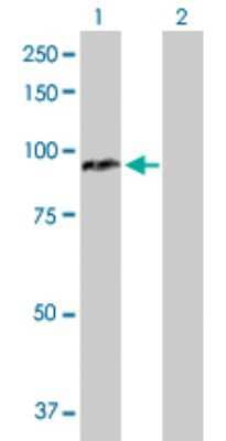 Western Blot: CPT1A Antibody [H00001374-D01P] - Analysis of CPT1A expression in transfected 293T cell line by CPT1A polyclonal antibody.Lane 1: CPT1A transfected lysate(88.40 KDa).Lane 2: Non-transfected lysate.