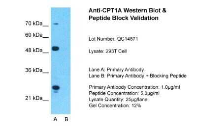 Western Blot: CPT1A Antibody [NBP1-59608] - Sample Tissue: 293T, Lane A: Primary Antibody, Lane B: Primary Antibody + Blocking Peptide, Primary Antibody Concentration: 1ug/ml, Peptide Concentration: 5ug/ml, Lysate Quantity: 25ug/lane/lane, Gel Concentration: 0.12