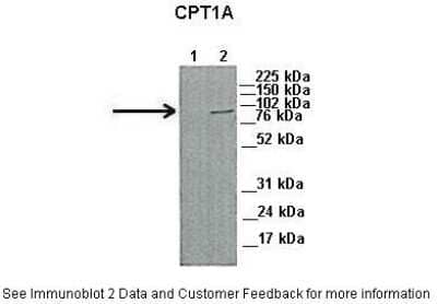 Western Blot: CPT1A Antibody [NBP1-59608] - Lanes: 1. 45ug capan1 cell lysate 2. 45 ug HPAF cell lysate Primary, Antibody Dilution: 1 : 1000 Secondary Antibody: Anti-Rabbit HRP Secondary, Antibody Dilution: 1 : 5000 Gene name: CPT1A.