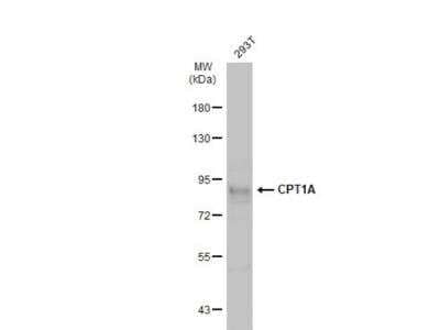 Western Blot: CPT1A Antibody [NBP2-15993] - Whole cell extract (30 ug) was separated by 7.5% SDS-PAGE, and the membrane was blotted with CPT1A antibody [C1C2], Internal diluted at 1:1000. The HRP-conjugated anti-rabbit IgG antibody (NBP2-19301) was used to detect the primary antibody.