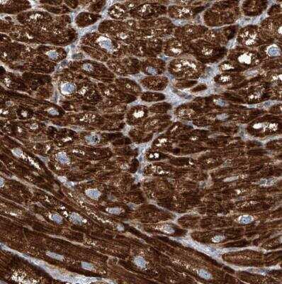 Immunohistochemistry-Paraffin: CPT1B Antibody [NBP1-84389] - Staining of human heart muscle shows strong cytoplasmic positivity in myocytes.