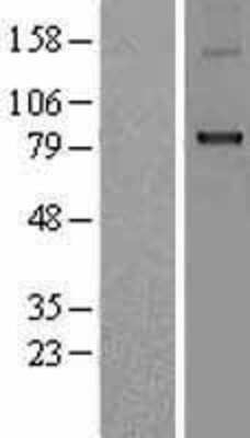 Western Blot: CPT1B Overexpression Lysate (Adult Normal) [NBP2-05412] Left-Empty vector transfected control cell lysate (HEK293 cell lysate); Right -Over-expression Lysate for CPT1B.