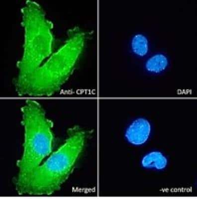 Immunocytochemistry/Immunofluorescence: CPT1C Antibody [NBP1-44064] - Immunofluorescence analysis of paraformaldehyde fixed U251 cells, permeabilized with 0.15% Triton. Primary incubation 1hr (10 ug/mL) followed by Alexa Fluor 488 secondary antibody (2 ug/mL), showing membrane and cytoplasmic staining. The nuclear stain is DAPI (blue). Negative control: Unimmunized goat IgG (10 ug/mL) followed by Alexa Fluor 488 secondary antibody (2 ug/mL).