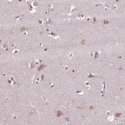 Immunocytochemistry/Immunofluorescence: CPT1C Antibody [NBP2-68811] - Immunohistochemical staining of human cerebral cortex shows cytoplasmic positivity in neuronal cells.