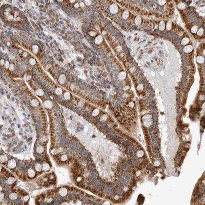 Immunohistochemistry-Paraffin: CPT2 Antibody [NBP1-85470] - Staining of human colon shows strong cytoplasmic positivity in glandular cells.