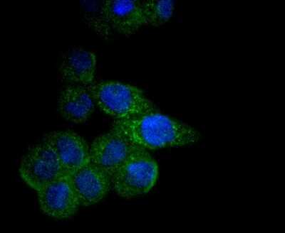 Immunocytochemistry/Immunofluorescence: CPT2 Antibody (SN06-70) [NBP2-67699] - Staining CPT2 in SW480 cells (green). The nuclear counter stain is DAPI (blue). Cells were fixed in paraformaldehyde, permeabilised with 0.25% Triton X100/PBS.