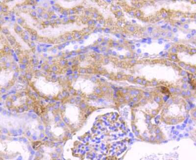 Immunohistochemistry-Paraffin: CPT2 Antibody (SN06-70) [NBP2-67699] - Analysis of paraffin-embedded mouse kidney tissue using anti-CPT2 antibody. Counter stained with hematoxylin.
