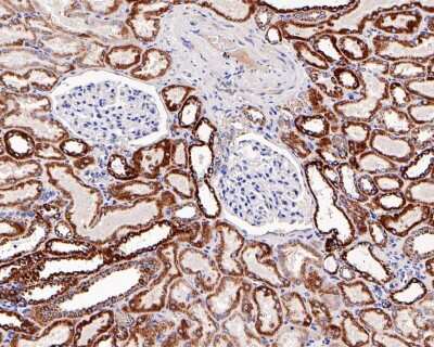 Immunohistochemistry-Paraffin: CPT2 Antibody (SN06-70) [NBP2-67699] - Analysis of paraffin-embedded human kidney tissue with Rabbit anti-CPT2 antibody. The section was pre-treated using heat mediated antigen retrieval with Tris-EDTA buffer (pH 9.0) for 20 minutes. The tissues were blocked in 1% BSA for 20 minutes at room temperature, washed with ddH2O and PBS, and then probed with the primary antibody for 1 hour at room temperature. The detection was performed using an HRP conjugated compact polymer system. DAB was used as the chromogen. Tissues were counterstained with hematoxylin and mounted with DPX.