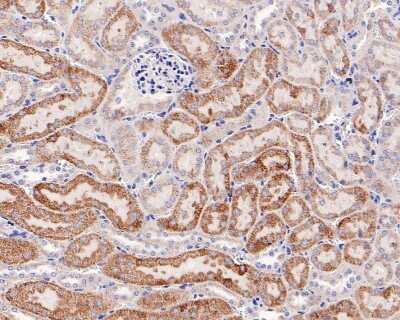 Immunohistochemistry-Paraffin: CPT2 Antibody (SN06-70) [NBP2-67699] - Analysis of paraffin-embedded mouse kidney tissue with Rabbit anti-CPT2 antibody. The section was pre-treated using heat mediated antigen retrieval with Tris-EDTA buffer (pH 9.0) for 20 minutes. The tissues were blocked in 1% BSA for 20 minutes at room temperature, washed with ddH2O and PBS, and then probed with the primary antibody for 1 hour at room temperature. The detection was performed using an HRP conjugated compact polymer system. DAB was used as the chromogen. Tissues were counterstained with hematoxylin and mounted with DPX.