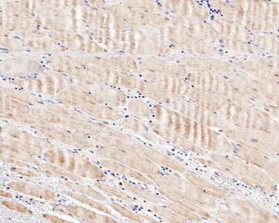 Immunohistochemistry-Paraffin: CPT2 Antibody (SN06-70) [NBP2-67699] - Analysis of paraffin-embedded human muscle tissue with Rabbit anti-CPT2 antibody. The section was pre-treated using heat mediated antigen retrieval with Tris-EDTA buffer (pH 9.0) for 20 minutes. The tissues were blocked in 1% BSA for 20 minutes at room temperature, washed with ddH2O and PBS, and then probed with the primary antibody for 1 hour at room temperature. The detection was performed using an HRP conjugated compact polymer system. DAB was used as the chromogen. Tissues were counterstained with hematoxylin and mounted with DPX.