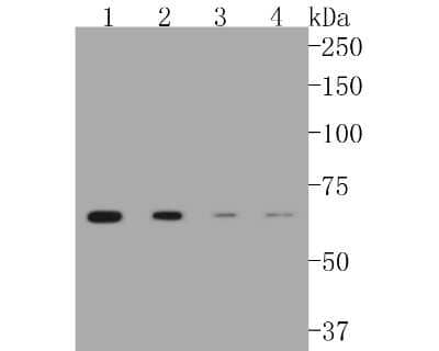 Western Blot: CPT2 Antibody (SN06-70) [NBP2-67699] - Western blot analysis of CPT2 on different lysates. Proteins were transferred to a PVDF membrane and blocked with 5% BSA in PBS for 1 hour at room temperature. The primary antibody (1/500) was used in 5% BSA at room temperature for 2 hours. Goat Anti-Rabb