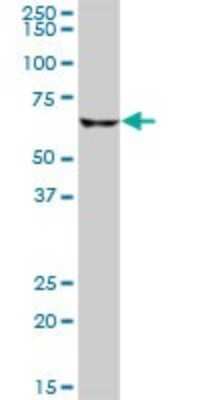 Western Blot: CPT2 Antibody [H00001376-B01P] - Analysis of CPT2 expression in human liver.