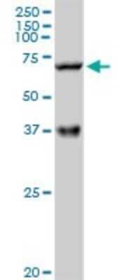 Western Blot: CPT2 Antibody [H00001376-D01P] - Analysis of CPT2 expression in mouse kidney.