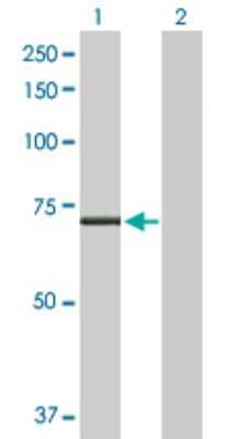 Western Blot: CPT2 Antibody [H00001376-D01P] - Analysis of CPT2 expression in transfected 293T cell line by CPT2 polyclonal antibody.Lane 1: CPT2 transfected lysate(73.80 KDa).Lane 2: Non-transfected lysate.