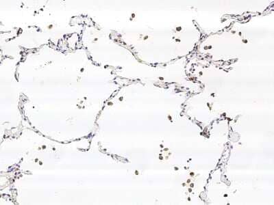 Immunohistochemistry-Paraffin: CPVL Antibody [NBP2-97080] - Staining of human CPVL in human lung with rabbit polyclonal antibody (1:10000).