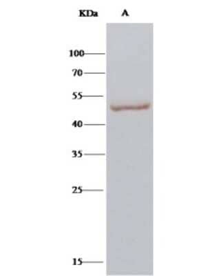Immunoprecipitation: CPVL Antibody [NBP2-97080] - CPVL was immunoprecipitated using: Lane A: 0.5 mg HepG2 Whole Cell Lysate 2 ul anti-CPVL rabbit polyclonal antibody and 15 ul of 50 % Protein G agarose. Primary antibody: Anti-CPVL rabbit polyclonal antibody, at 1:100 dilution. Secondary antibody: Clean-Bloto IP Detection Reagent (HRP) at 1:1000 dilution. Developed using the DAB staining technique. Performed under reducing conditions. Predicted band size: 54 kDa. Observed band size: 54 kDa
