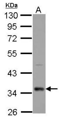 Western Blot: CPXCR1 Antibody [NBP2-15995] - Sample (30 ug of whole cell lysate) A: HL-60 10% SDS PAGE gel, diluted at 1:5000.
