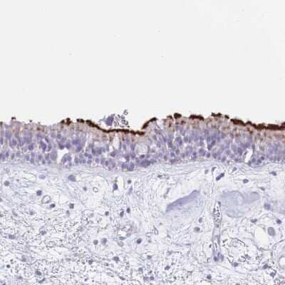 Immunohistochemistry-Paraffin CPXM2 Antibody