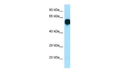 Western Blot: CR1L Antibody [NBP3-09478] - Western blot analysis of CR1L in Fetal Brain as a positive control. Antibody dilution at 1.0 ug/ml