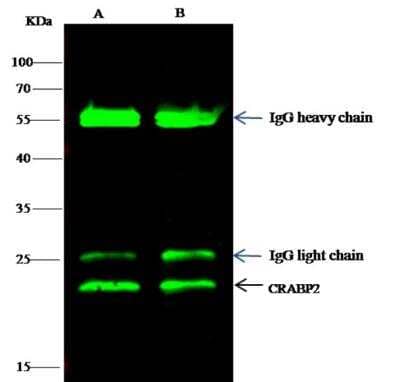 Immunoprecipitation: CRABP2 Antibody (004) [NBP2-89836] - Lane A:0.5 mg 293T Whole Cell Lysate Lane B:0.5 mg Raji Whole Cell Lysate0.5 uL anti-CRABP2 rabbit monoclonal antibody and 60 ug of Immunomagnetic beads Protein G. Primary antibody: Anti-CRABP2 rabbit monoclonal antibody,at 1:500 dilution  Secondary antibody: Dylight 800-labeled antibody to rabbit IgG (H+L), at 1:5000 dilution Developed using the odssey technique. Performed under reducing conditions. Predicted band size: 16 kDa Observed band size: 16 kDa