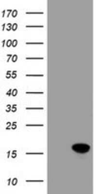 Western Blot: CRABP2 Antibody (10D6) [NBP2-03807] - HEK293T cells were transfected with the pCMV6-ENTRY control (Left lane) or pCMV6-ENTRY CRABP2 (Right lane) cDNA for 48 hrs and lysed. Equivalent amounts of cell lysates (5 ug per lane) were separated by SDS-PAGE and immunoblotted with anti-CRABP2.