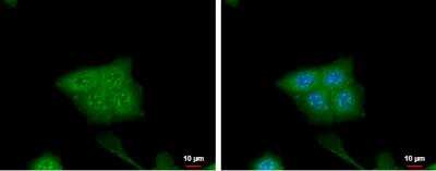 Immunocytochemistry/Immunofluorescence: CRABP2 Antibody [NBP2-15998] -  HCT116 cells were fixed in 4% paraformaldehyde at RT for 15 min. Green: CRABP2 protein stained by CRABP2 antibody [N1C3] diluted at 1:500. Blue: Hoechst 33342 staining.