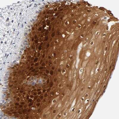 Immunohistochemistry-Paraffin: CRABP2 Antibody [NBP1-85465] - Staining of human vulva/anal skin shows strong nuclear and cytoplasmic positivity in squamous epithelial cells.