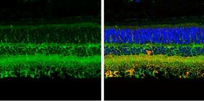 Immunohistochemistry-Paraffin: CRABP2 Antibody [NBP2-15998] - Paraffin-Embedded adult mouse retina. Green: CRABP2 protein stained by CRABP2 antibody [N1C3] diluted at 1:250. Red: beta Tubulin 3/ TUJ1, stained by beta Tubulin 3/ TUJ1 antibody [11710] diluted at 1:500. Blue: Fluoroshield with DAPI. 