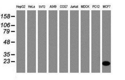 Western Blot: CRABP2 Antibody (OTI10D6) - Azide and BSA Free [NBP2-70448] - Analysis of extracts (35ug) from 9 different cell lines by using g anti-CRABP2 monoclonal antibody (HepG2: human; HeLa: human; SVT2: mouse; A549: human; COS7: monkey; Jurkat: human; MDCK: canine; PC12: rat; MCF7: human).
