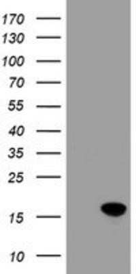 Western Blot: CRABP2 Antibody (OTI10D6) - Azide and BSA Free [NBP2-70448] - HEK293T cells were transfected with the pCMV6-ENTRY control (Left lane) or pCMV6-ENTRY CRABP2 (Right lane) cDNA for 48 hrs and lysed. Equivalent amounts of cell lysates (5 ug per lane) were separated by SDS-PAGE and immunoblotted with anti-CRABP2.