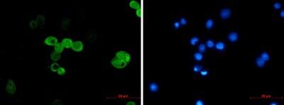 Immunocytochemistry/Immunofluorescence: CRABP2 Antibody (S01-4C4) [NBP3-19505] - Immunofluorescence of CRABP2 (green) in MCF-7 using CRABP2 antibody at dilution 1/20, and DAPI (blue)