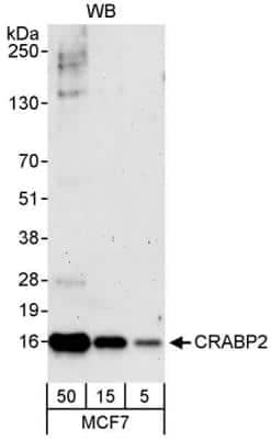 Western Blot: CRABP2 Antibody [NB100-2590] - Whole cell lysate (5, 15 and 50 ug) from MCF7 cells. Antibody used at 0.04 ug/ml.