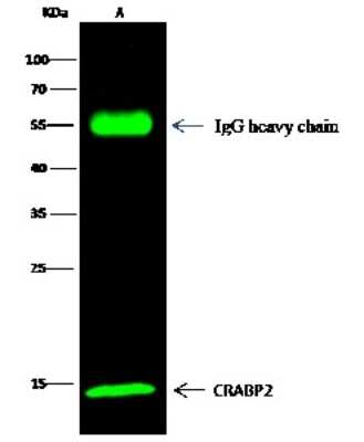 Western Blot: CRABP2 Antibody [NBP2-99740] - CRABP2 was immunoprecipitated using: Lane A: 0.5 mg MCF-7 Whole Cell Lysate 2 ul anti-CRABP2 rabbit polyclonal antibody and 15 ul of 50 % Protein G agarose. Primary antibody: Anti-CRABP2 rabbit polyclonal antibody, at 1:200 dilution. Secondary antibody: Dylight 800-labeled antibody to rabbit IgG (H+L), at 1:5000 dilution. Developed using the Odyssey technique. Performed under reducing conditions. Predicted band size: 16 kDa. Observed band size: 16 kDa