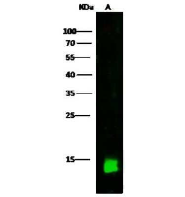 Western Blot: CRABP2 Antibody [NBP2-99740] - Anti-CRABP2 rabbit polyclonal antibody at 1:500 dilution. Lane A: MCF7 Whole Cell Lysate. Lysates/proteins at 30 ug per lane. Secondary Goat Anti-Rabbit IgG H&L (Dylight 800) at 1/10000 dilution. Developed using the Odyssey technique. Performed under reducing conditions. Predicted band size: 16 kDa. Observed band size: 14 kDa