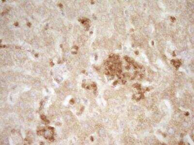 Immunohistochemistry-Paraffin: CRACC/SLAMF7 Antibody (OTI1F1) - Azide and BSA Free [NBP2-72107] - Staining of paraffin-embedded Human liver tissue within the normal limits using anti-SLAMF7 mouse monoclonal antibody. (Heat-induced epitope retrieval by 1 mM EDTA in 10mM Tris, pH8.5, 120 degrees C for 3min.