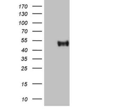 Western Blot: CRACC/SLAMF7 Antibody (OTI1F1) - Azide and BSA Free [NBP2-72107] - HEK293T cells were transfected with the pCMV6-ENTRY control (Left lane) or pCMV6-ENTRY SLAMF7 (RC220985, Right lane) cDNA for 48 hrs and lysed. Equivalent amounts of cell lysates (5 ug per lane) were separated by SDS-PAGE and immunoblotted with anti-SLAMF7. Positive lysates  (100ug) and (20ug).