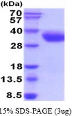 SDS-Page: Recombinant Human CRACC/SLAMF7 Protein [NBP2-52258] -  15% SDS Page (3 ug)