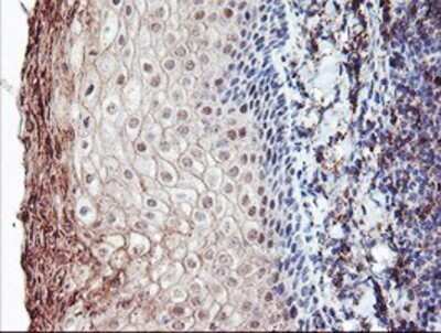 Immunohistochemistry: CRALBP Antibody (OTI1G6) - Azide and BSA Free [NBP2-71275] - Staining of paraffin-embedded Human tonsil using anti-CRALBP mouse monoclonal antibody.