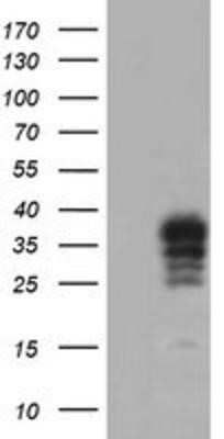 Western Blot: CRALBP Antibody (OTI1G6) - Azide and BSA Free [NBP2-71275] - HEK293T cells were transfected with the pCMV6-ENTRY control (Left lane) or pCMV6-ENTRY CRALBP (Right lane) cDNA for 48 hrs and lysed. Equivalent amounts of cell lysates (5 ug per lane) were separated by SDS-PAGE and immunoblotted with anti-CRALBP.