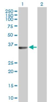 Western Blot: CRALBP Antibody [H00006017-D01P] - Analysis of RLBP1 expression in transfected 293T cell line by RLBP1 polyclonal antibody.Lane 1: RLBP1 transfected lysate(36.50 KDa).Lane 2: Non-transfected lysate.