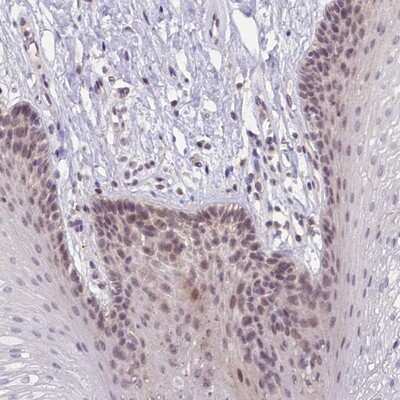 Immunohistochemistry-Paraffin: CRAMP1L Antibody [NBP1-93589] - Staining of human oral mucosa shows moderate nuclear positivity in squamous epithelial cells.