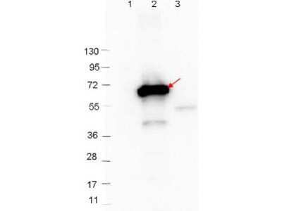 Western Blot: CRASP-2 Antibody [NBP2-21651] - Detection of 0.1 ug of recombinant CRASP-2 protein. Lane 1: Molecular weight markers. Lane 2: MBP-CRASP-2 fusion protein. Lane 3: MBP alone.  Protein was run on a 4-20% gel, then transferred to 0.45 um nitrocellulose.  After blocking with 1% BSA-TTBS  overnight at 4C, primary antibody was used at 1:1000 at room temperature for 30 min. HRP-conjugated Goat-Anti-Rabbit secondary antibody was used at 1:40,000 in Blocking Buffer and imaged on the 4000 imaging system.