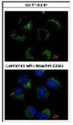 Immunocytochemistry/Immunofluorescence: CRAT Antibody [NBP1-32108] - Methanol-fixed H1299, using CRAT (NBP1-32108) antibody at 1:500 dilution.