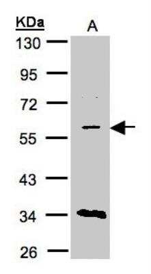Western Blot: CRAT Antibody [NBP1-32108] - Sample(30 ug of whole cell lysate)A:Raji   10% SDS PAGE, antibody diluted at 1:1500.